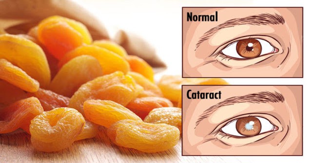 Start Eating These Foods The Moment You Notice Your Vision Getting Worse